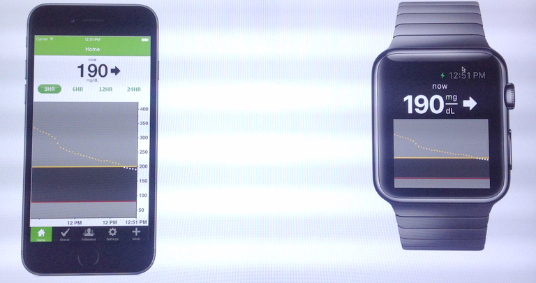 米医療機器メーカーのデクスコム、｢Apple Watch｣向けに血糖値アプリを開発中