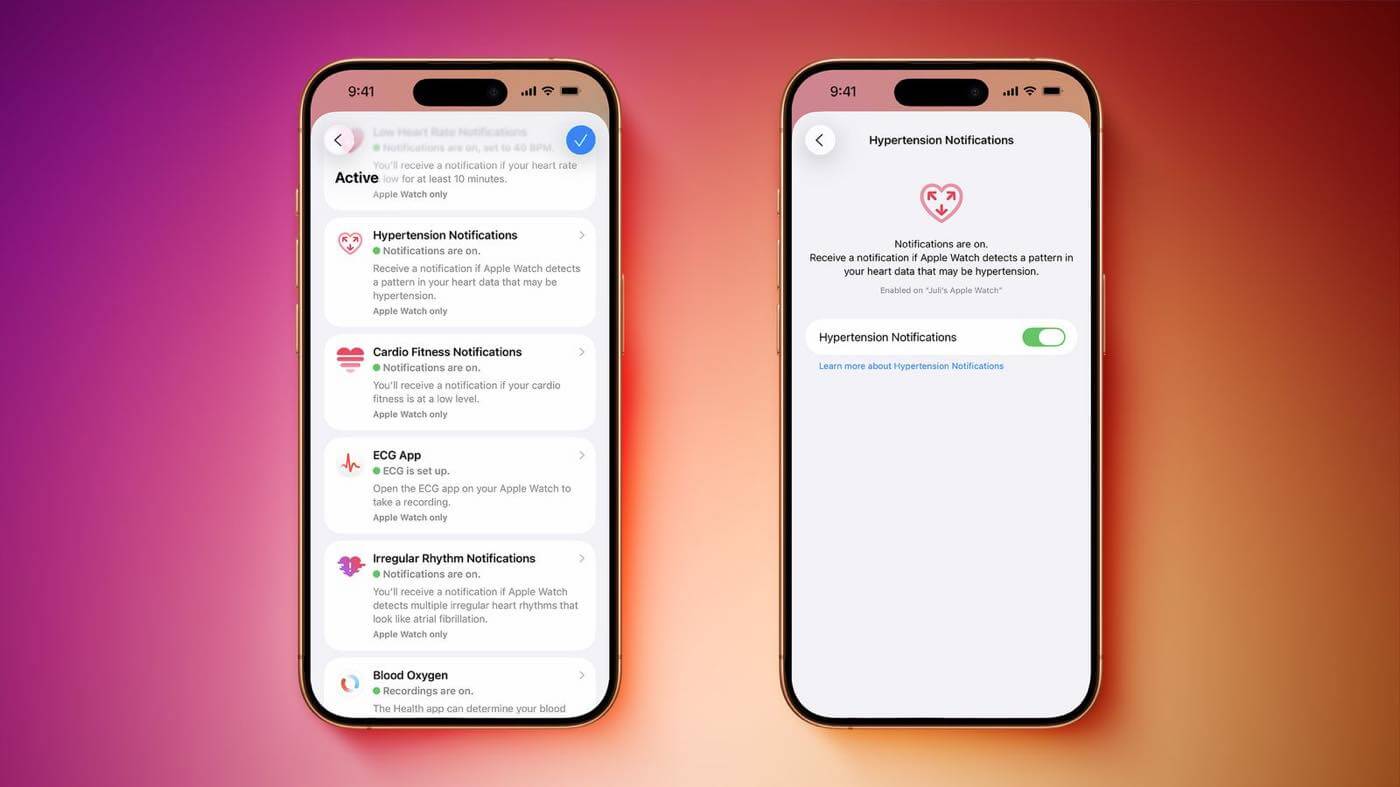 ｢iOS 26.2 beta 3｣の新機能や変更点のまとめ