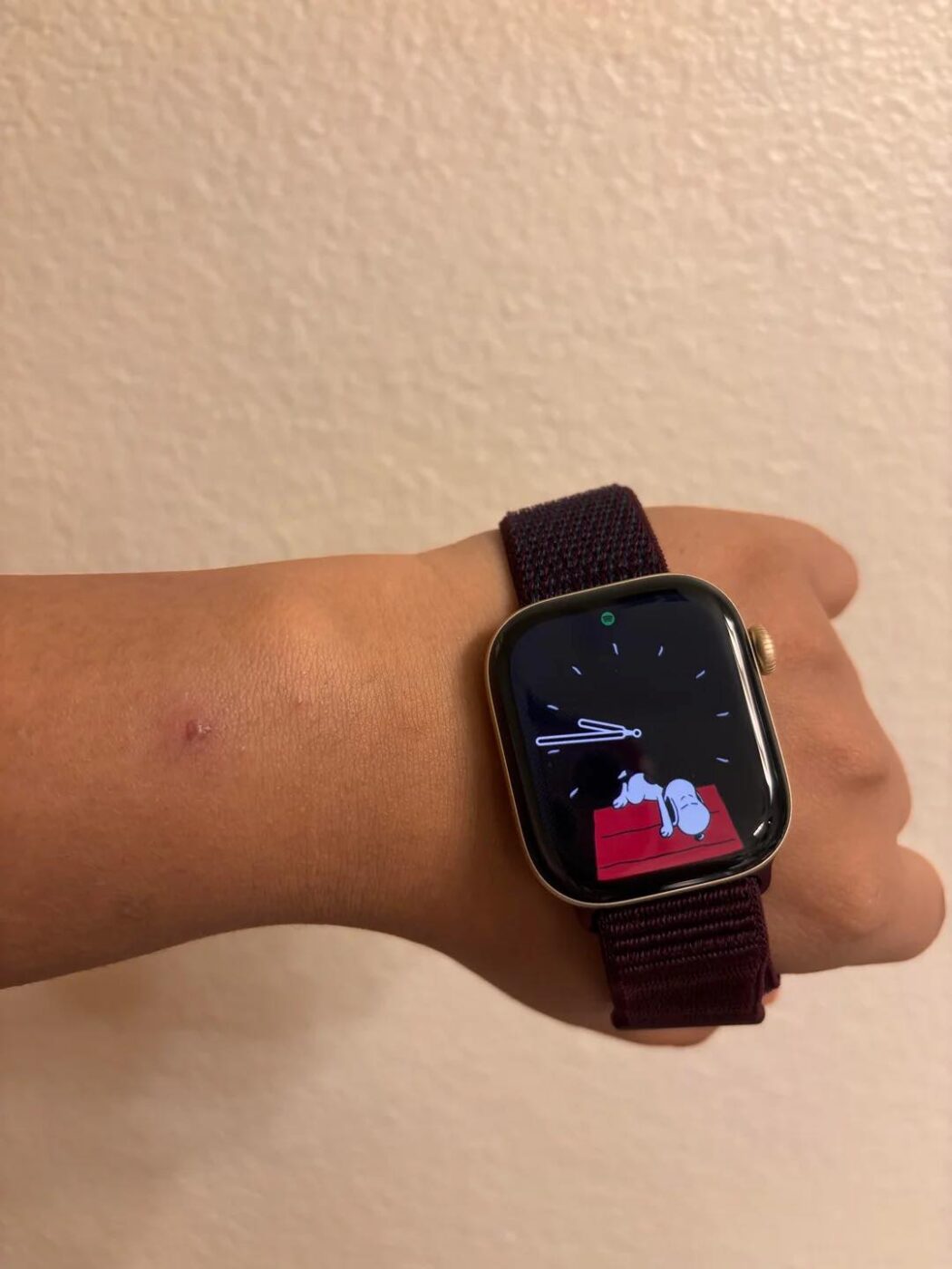 「Apple Watch Series 12」と「Apple Watch Ultra 4」の一部ユーザーから皮膚の炎症が報告される
